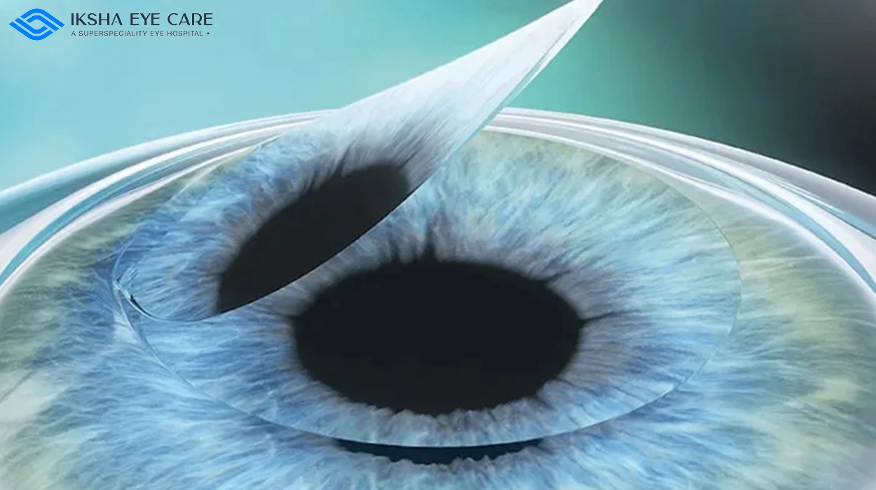 Can we get back spectacle power after LASIK surgery?